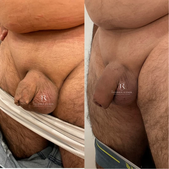 antes-e-depois-final-16