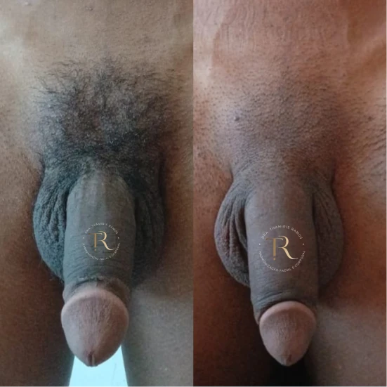 antes-e-depois-final-18