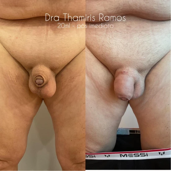 antes-e-depois-final-3