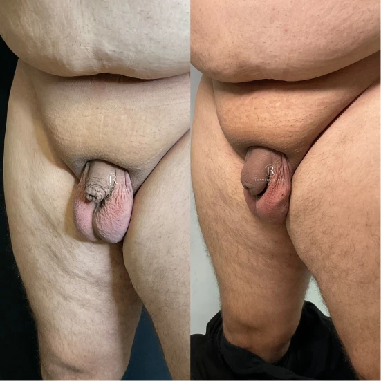antes-e-depois-final-8